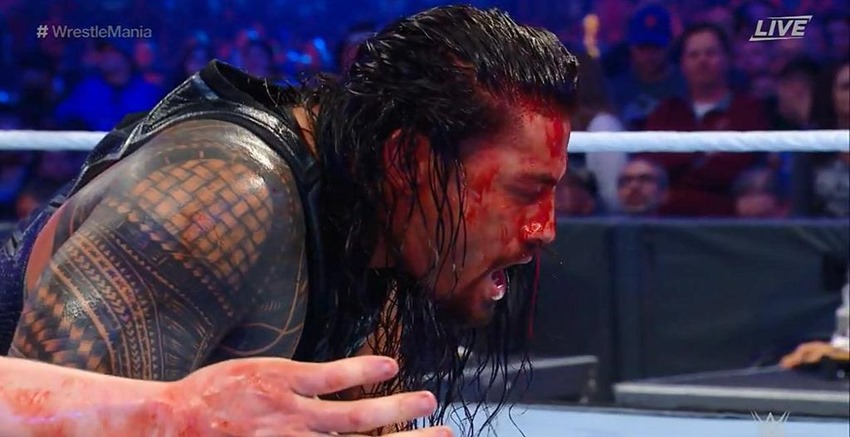 Wrestlemania shocks (11)