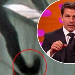 5 Unbelievable Celebrity Injuries You May Have Forgotten About...