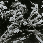 How to Lower Your Cancer Risk