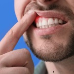 Can Castor Oil Prevent Gum Disease in Diabetics?